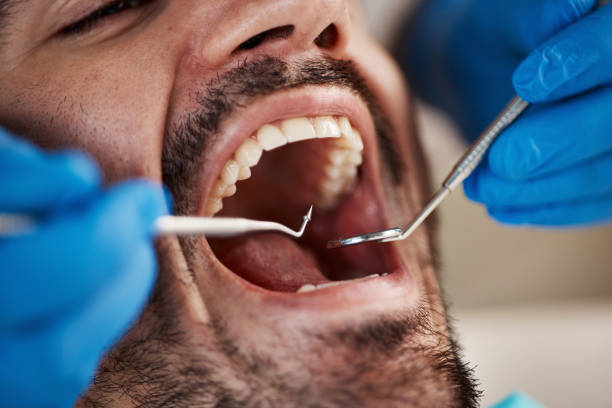 Best Holiday Emergency Dentist in Crystal Lake, CT