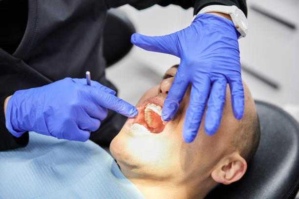 Best Emergency Dentist for Lost Fillings or Crowns in Crystal Lake, CT