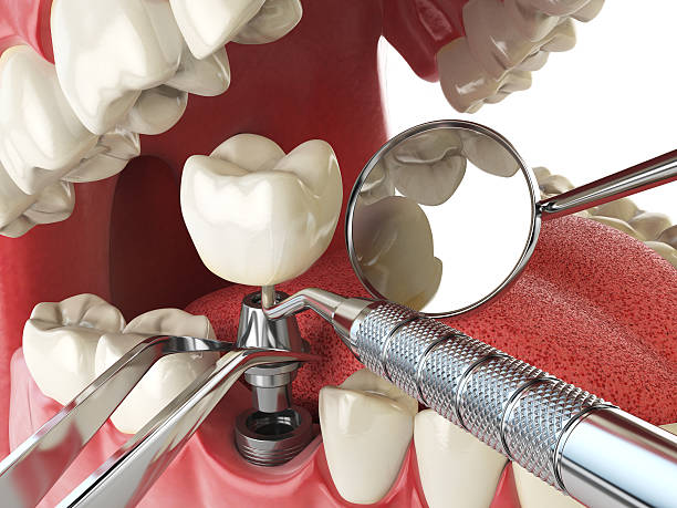 Best Orthodontic Emergency Dentist in Crystal Lake, CT